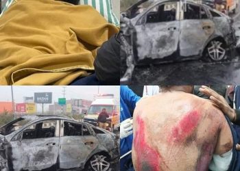 बड़ी खबर : ऋषभ पंत की हालत स्थिर। जानिए क्या बोले डॉक्टर