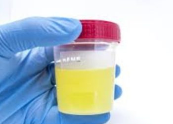 Health news: यदि आपके Urine से आती है स्मेल तो हो सकती है यह गंभीर बीमारी। पढ़िए पूरी जानकारी