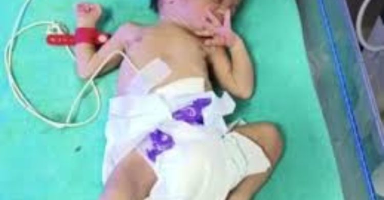 शर्मनाक: अस्पताल के टॉयलेट में बच्ची को जन्म देकर महिला फरार