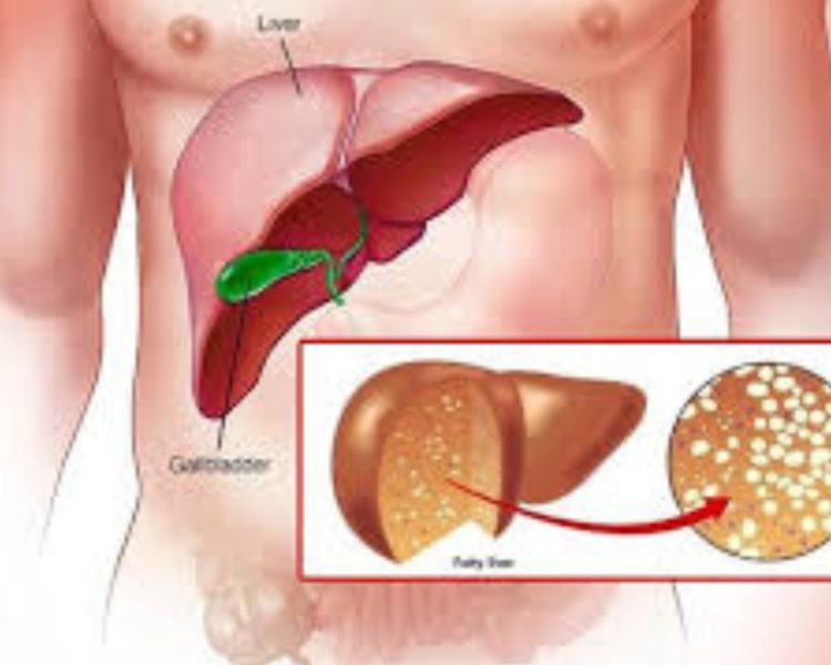 बिना शराब पिए भी खोखला हो सकता है लीवर, इन 5 संकेतों को न करें नजरअंदाज, हो सकती है ये बीमारी