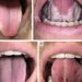Health news : जीभ पर दिखने लगे ये 3 बदलाव तो हो जाइए सावधान,जल्द हो सकती है किडनी खराब