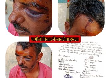 मुक्तेश्वर थाना क्षेत्र में जानलेवा हमले के बाद दिन रात सहमा हुआ हैं एक परिवार,तहरीर पर मुकदमें का इंतजार