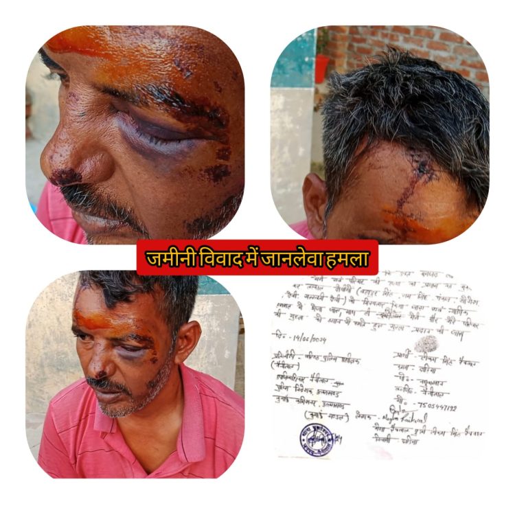 मुक्तेश्वर थाना क्षेत्र में जानलेवा हमले के बाद दिन रात सहमा हुआ हैं एक परिवार,तहरीर पर मुकदमें का इंतजार