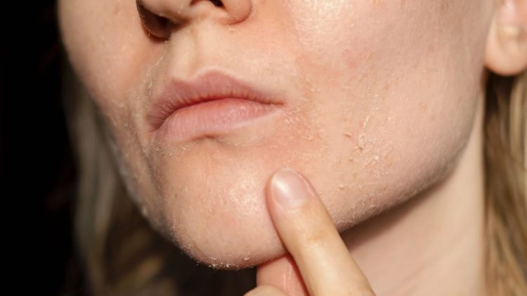 सुंदर दिखने की चाहत में कहीं बर्बाद तो नहीं कर रहीं अपनी स्किन? जानिए सच्चाई!