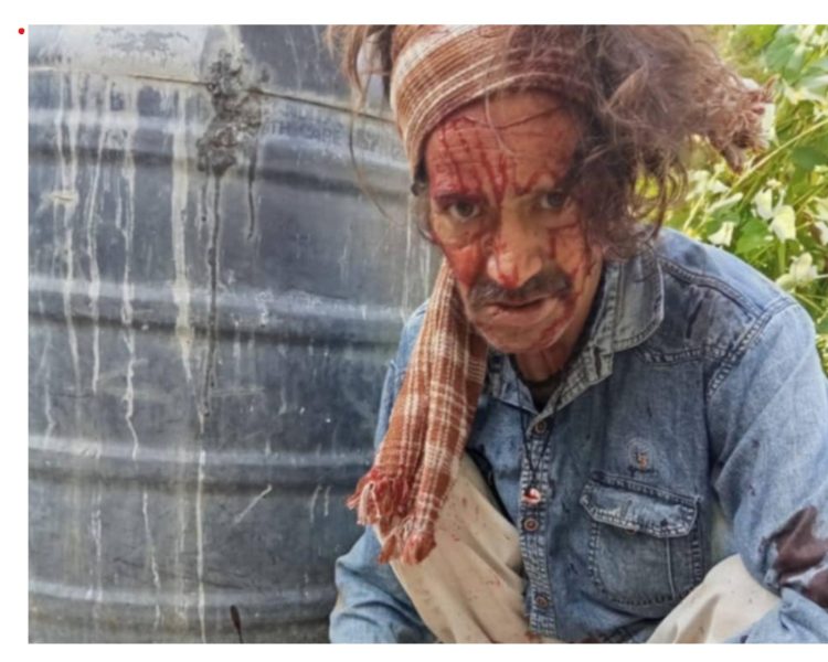 गुलदार के हमले ने ढंगसयोली गाँव में बढ़ाई दहशत — प्रशासन पर ग्रामीणों का आक्रोश