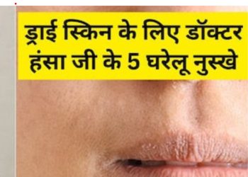 बदलते मौसम में ड्राई हो रही है स्किन? तो अपनाएं ये 5 घरेलू नुस्खे, रूखेपन से मिलेगा छुटकारा