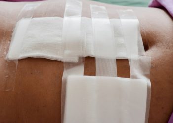 देहरादून: निजी अस्पताल की लापरवाही से महिला की मौत, सिजेरियन के बाद पेट में छूट गई कॉटन पट्टी