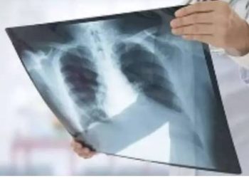 बड़ी खबर : देहरादून बना टीबी हॉटस्पॉट, पहाड़ में पौड़ी सबसे ज्यादा प्रभावित