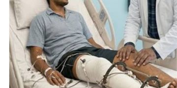 बड़ी खबर : औद्योगिक हादसे में कटा पैर, मैक्स अस्पताल के डॉक्टरों ने 8 घंटे की जटिल सर्जरी कर युवक को दी नई उम्मीद