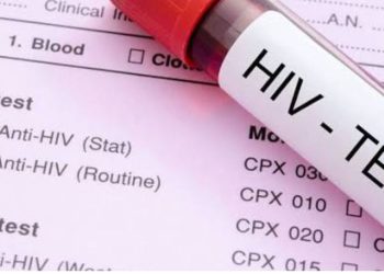 सनसनी: बहन की मौत के बाद जीजा के खिलाफ मुकदमा, HIV रिपोर्ट को लेकर बड़ा खुलासा