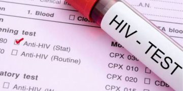 सनसनी: बहन की मौत के बाद जीजा के खिलाफ मुकदमा, HIV रिपोर्ट को लेकर बड़ा खुलासा