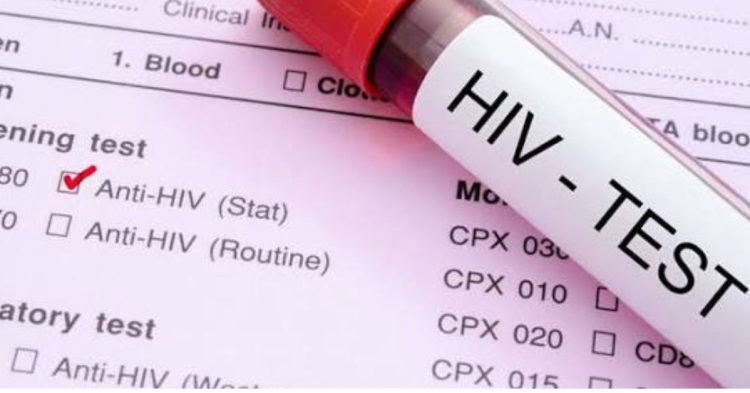 सनसनी: बहन की मौत के बाद जीजा के खिलाफ मुकदमा, HIV रिपोर्ट को लेकर बड़ा खुलासा