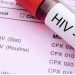 सनसनी: बहन की मौत के बाद जीजा के खिलाफ मुकदमा, HIV रिपोर्ट को लेकर बड़ा खुलासा